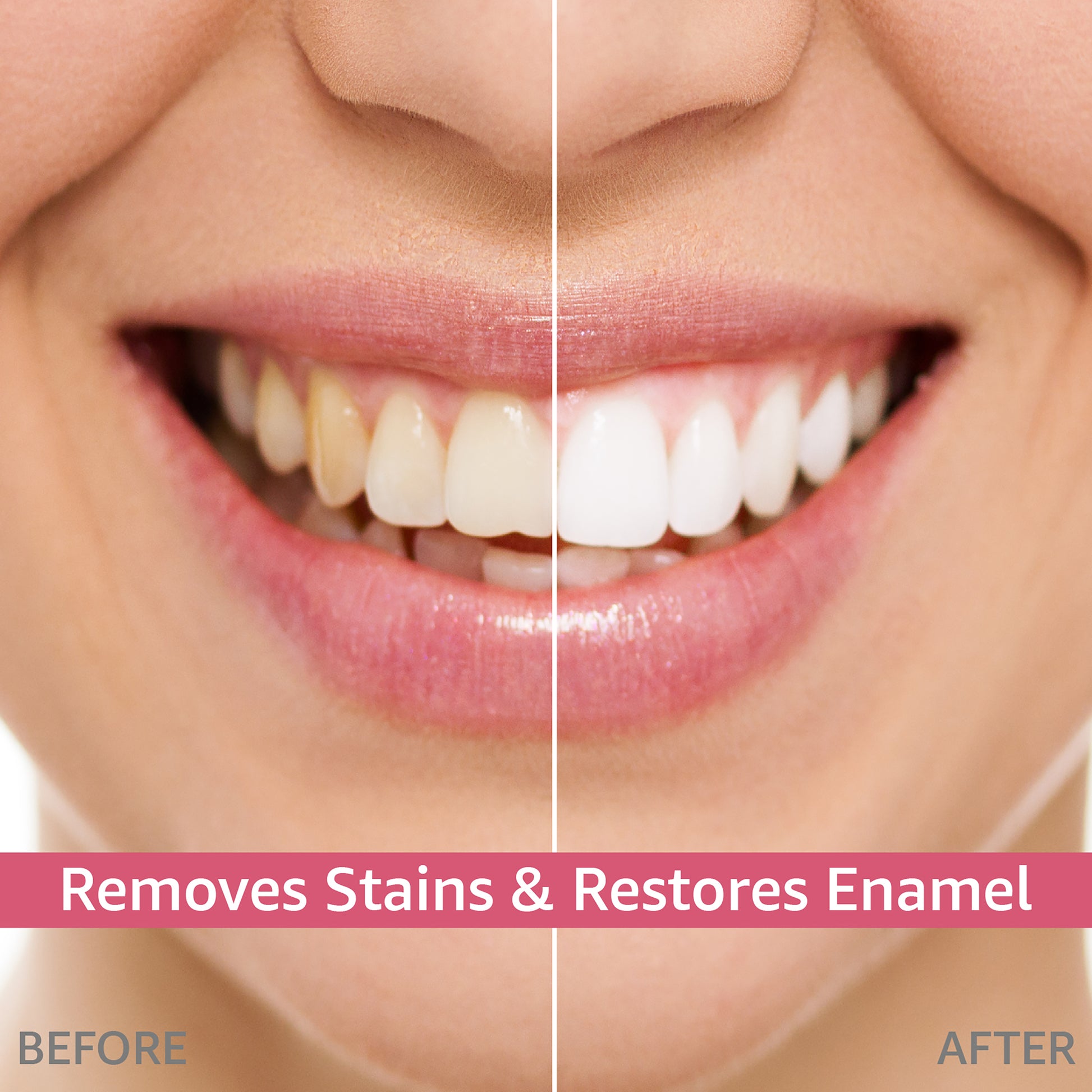 Removes stains & restores enamel