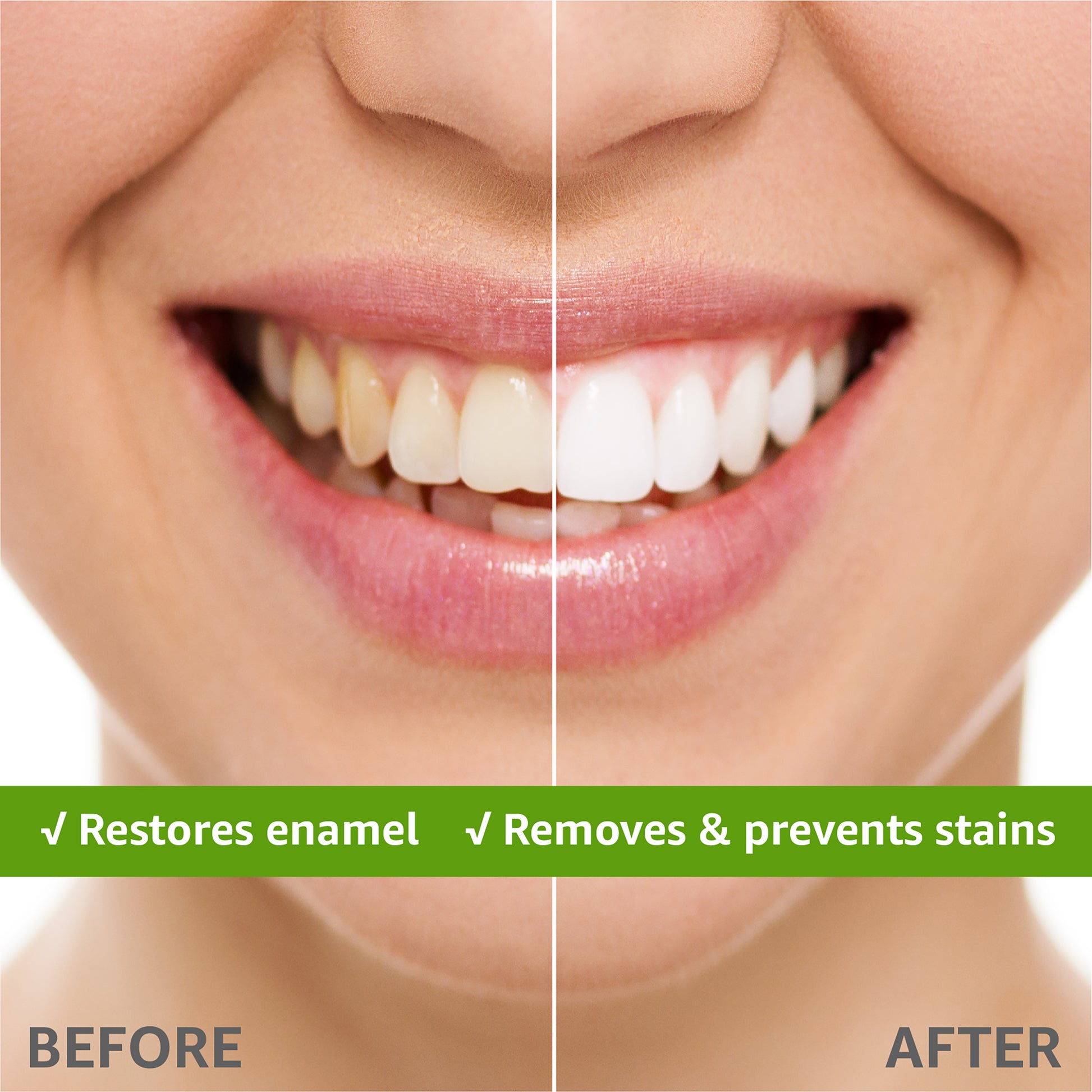 Restores enamel, removes & prevents stains